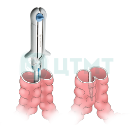 Линейный сшивающе-режущий аппарат, c кассетой синего цвета для стандартной ткани,длина шва 100 мм