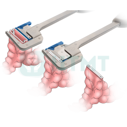 Линейный сшивающий аппарат, c кассетой синего цвета для стандартной ткани,длина шва 45 мм
