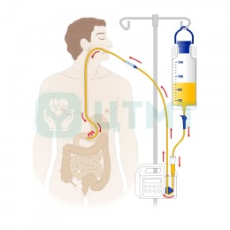 Набор для введения энтерального питания с помощью насоса, объем 1000 мл