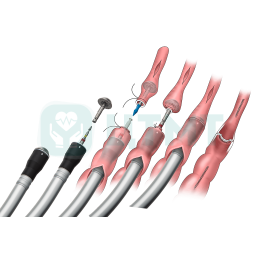 Циркулярный изогнутый сшивающий аппарат с регулируемой высотой закрытия скоб, диаметр рабочей части 32 мм, высота скобы 5,0 мм