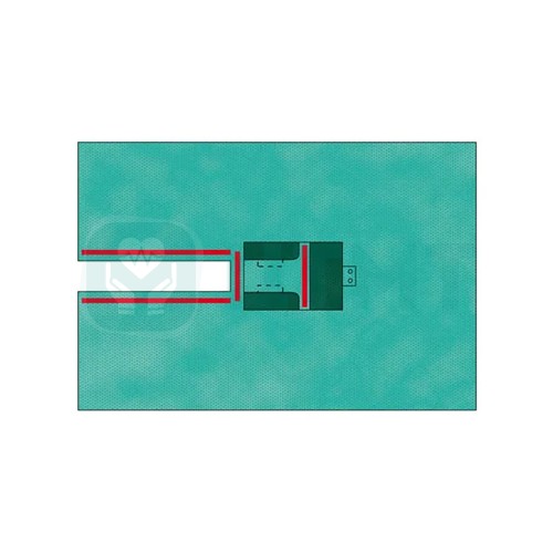 Простыня операц. с вырезом, 2-слойная Raucodrape OR Split Sheets 10 х 100 см, 225 х 260 см, 33069